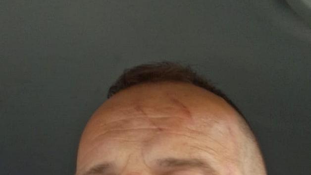 [VIDEO] Rutkowski na tropie byłych policjantów. Dariusz  Albrychowicz twierdzi, że został brutalnie pobity 
